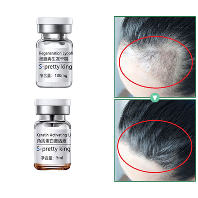El suero del crecimiento del pelo fija la esencia estimulante del cuidado del cabello del tratamiento del tratamiento del pelo de la pérdida del Anti-pelo de los equipos
