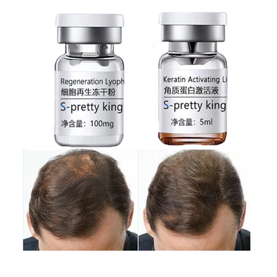 El suero del crecimiento del pelo fija la esencia estimulante del cuidado del cabello del tratamiento del tratamiento del pelo de la pérdida del Anti-pelo de los equipos