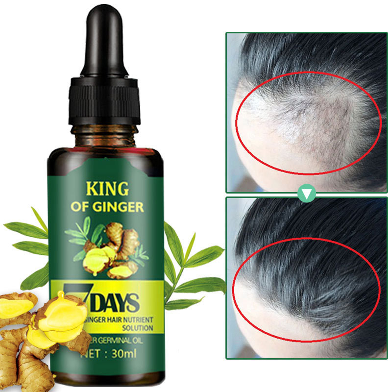 Esencia rápida eficaz del crecimiento del pelo del tratamiento del cuero cabelludo del crecimiento del tratamiento de la pérdida de pelo de Germinal Serum Essence Oil Natural