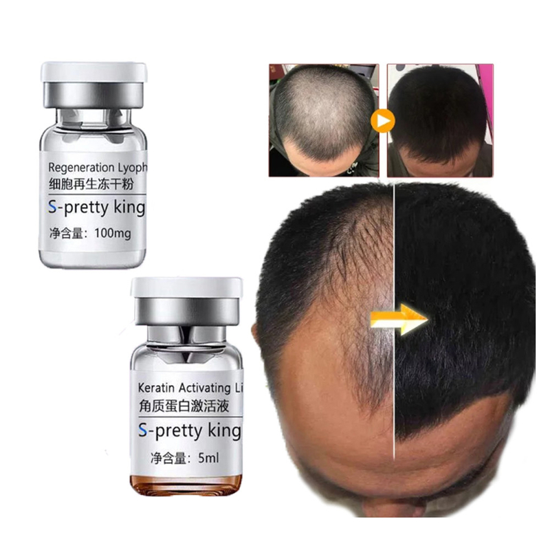 El suero del crecimiento del pelo fija la esencia estimulante del cuidado del cabello del tratamiento del tratamiento del pelo de la pérdida del Anti-pelo de los equipos