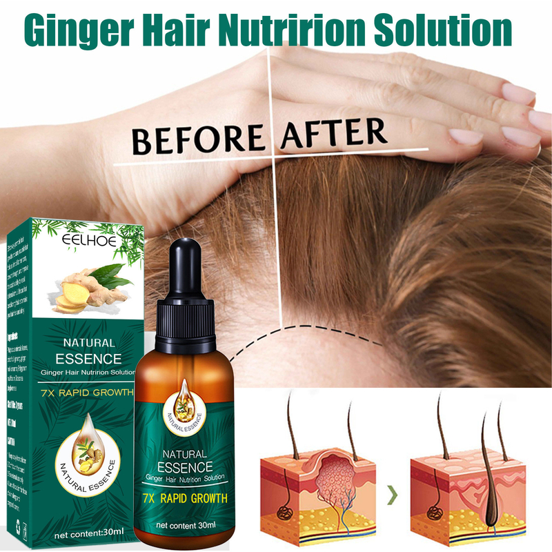 Pelo del crecimiento del tratamiento de la pérdida de pelo del aceite de la esencia del suero del crecimiento del pelo de Ginger Hair Growth Essence Germinal para las mujeres de los hombres